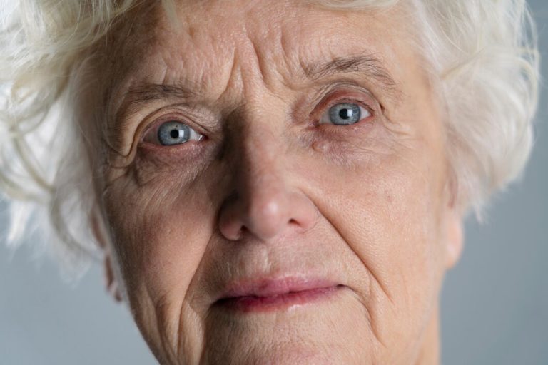 How Does Frontotemporal Dementia Affect Vision, and What Signs to Look for?
